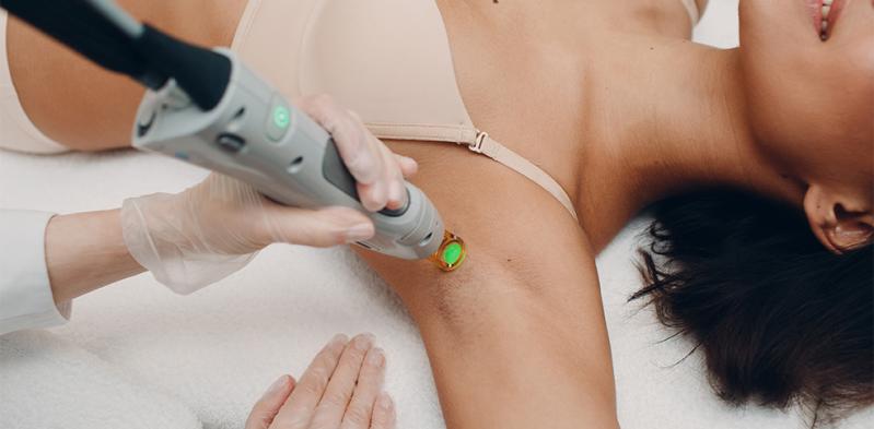 Epilation laser