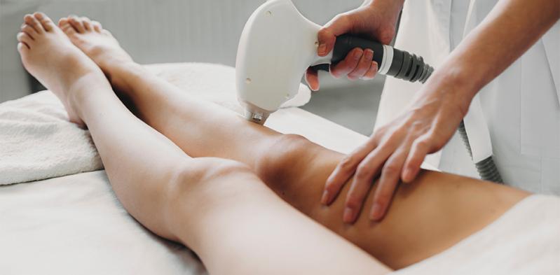 Epilation laser